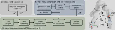 Workflow and building blocks of the proposed robot-assisted ultrasound system
